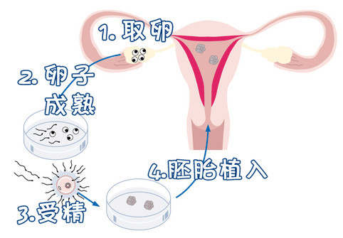冷冻室
